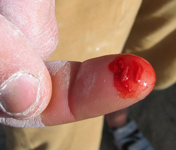 picture of finger